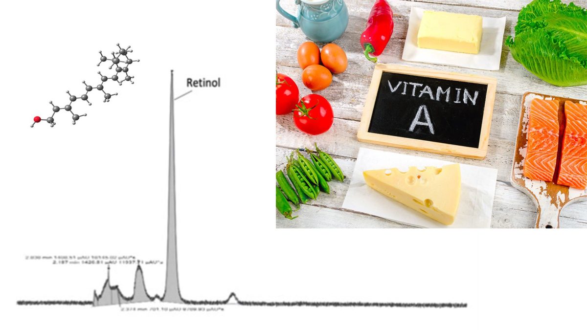 Etude du statut nutritionnel